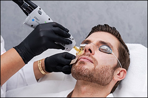 Zieda Aesthetic Clinic Breaks the Taboo Around Men's Aesthetic Treatments