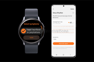 Electrocardiogram Monitoring Cleared for Galaxy Watch Active2 by South Korea's Ministry of Food and Drug Safety