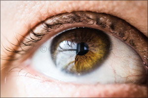 Experts at MEHD Warn Residents of the Risk of Developing Cataracts