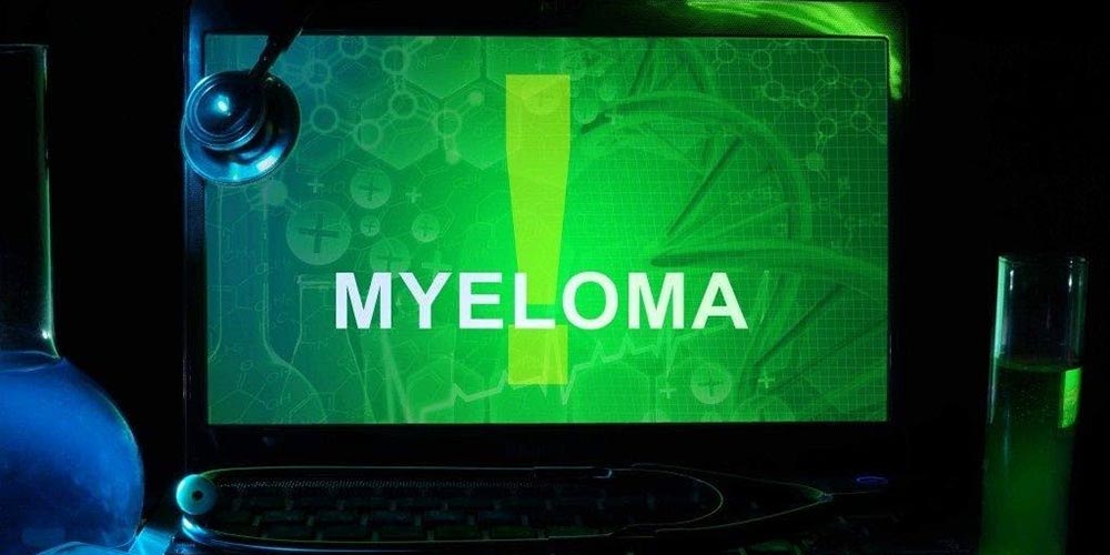 Mayo Clinic researchers find new hope for toughest myeloma through off-the-shelf immunotherapy
